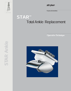 STAR™ Total Ankle Replacement