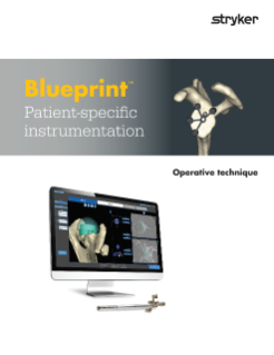 Blueprint PSI operative technique.pdf