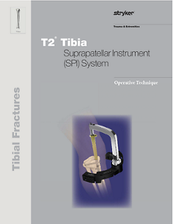 T2 Tibia SPI System operative technique