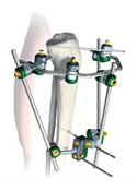 Hoffmann II MRI System