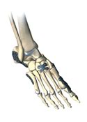 VariAx Foot Locking Plate System