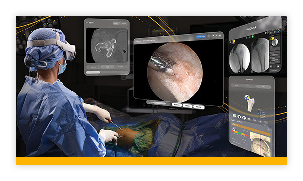 Stryker introduces first of its kind FDA-authorized surgical application for Apple Vision Pro with hip arthroscopy case at nationally recognized academic medical center