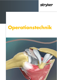 Stryker InSpace Schulterballon OP-Technik.pdf