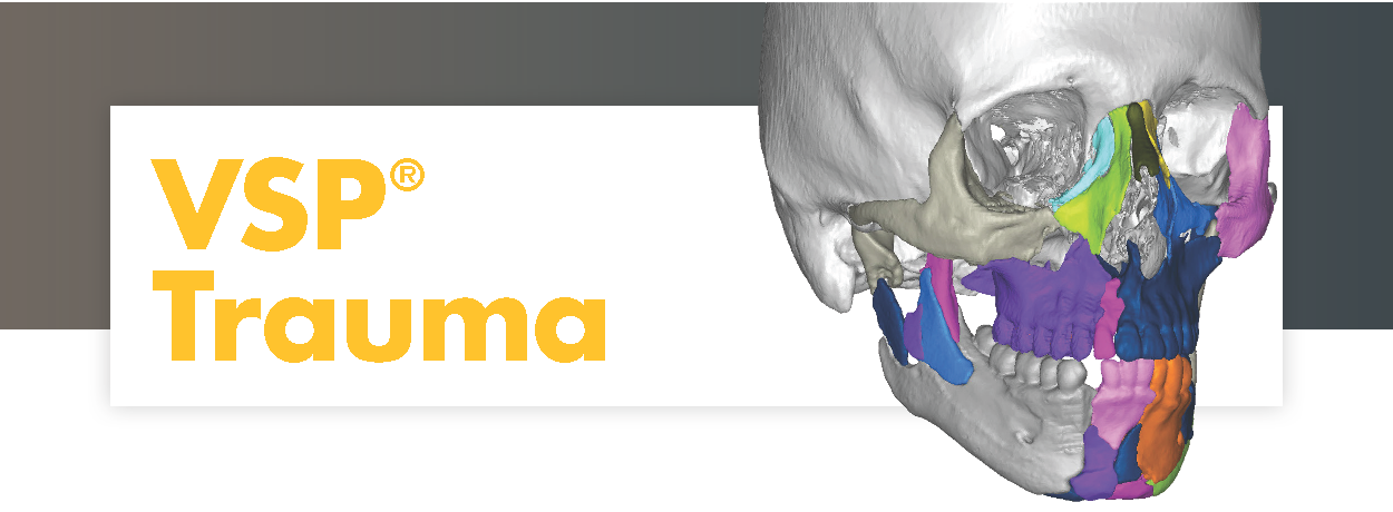 VSP® Reconstruction | Stryker