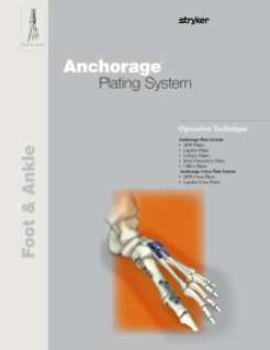 Anchorage Plating System | Operative Technique