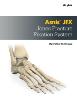 Asnis JFX | Operative Technique
