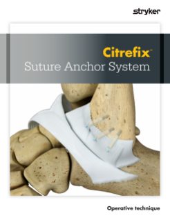 Citrefix Suture Anchor Operative Technique.pdf