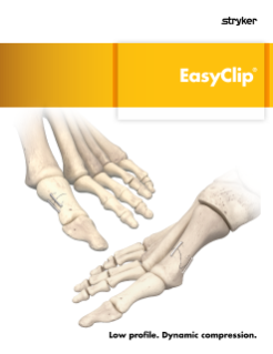 EasyClip | Features and benefits