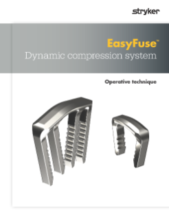 EasyFuse Operative Technique.pdf