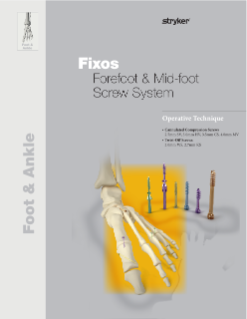 Fixos | Operative Technique