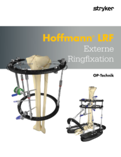 Hoffmann® LRF Externe Ringfixation OP-Technik