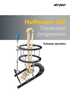 Technique opératoire Hoffmann LRF Correction