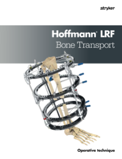 Hoffmann® LRF Bone Transport Operative technique