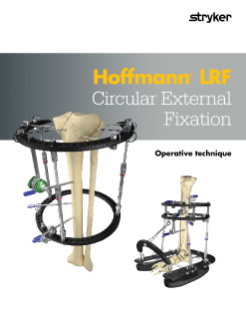 Hoffmann® LRF Circular External Fixation Operative technique