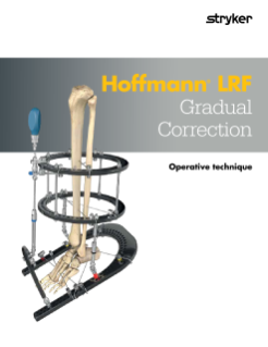 Hoffmann® LRF Gradual Correction Operative technique