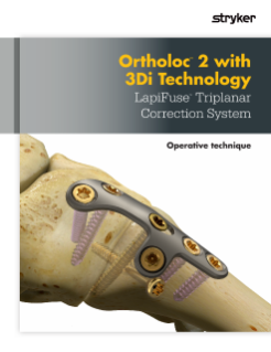 Ortholoc 2 Lapifuse | Operative Technique