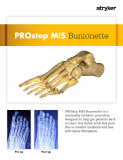 PROstep MIS Bunionette Sell Sheet.pdf
