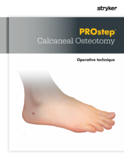 PROstep MIS Calcaneal Osteotomy Operative Technique.pdf