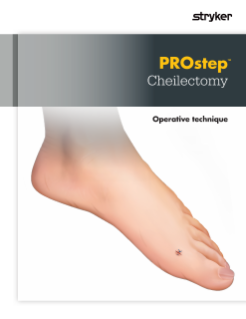 PROstep MIS Cheilectomy Operative Technique.pdf