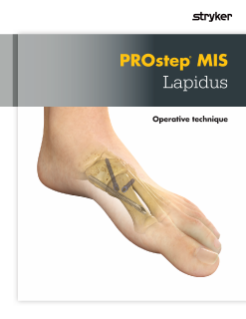 PROstep MIS Lapidus Operative Technique.pdf