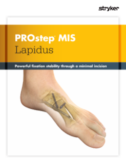 PROstep MIS Lapidus Sell Sheet.pdf