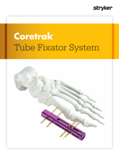Coretrak Tube Fixator System | brochure