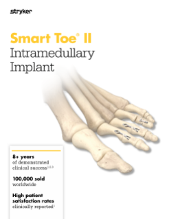 Smart Toe II Intramedullary Implant - Brochure