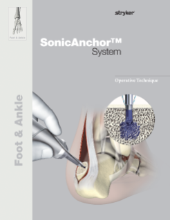 SonicAnchor Operative Technique