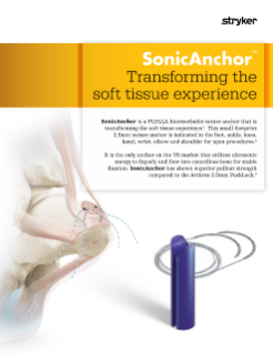 SonicAnchor features and benefits