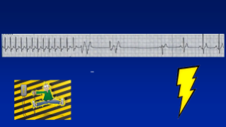 Mastering Pacing, Cardioversion and Defibrillation