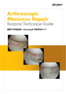 鏡視下半月縫合術－Henning法 手術手技ガイド