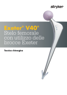 Exeter V40 Femoral Stem Using Exeter Broach Surgical Technique - Italian