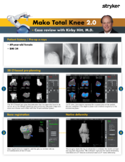 Mako Total Knee 2.0 - Case review with Kirby Hitt, M.D.
