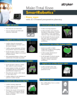 Mako Total Knee SmartRobotics™ Know more with 3D CT-based preoperative planning