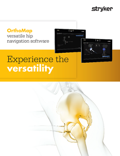OrthoMap Versatile Hip Software Brochure
