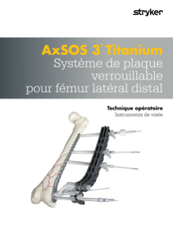 AxSOS 3® Titanium Système de plaque verrouillable pour fémur latéral distal Technique opératoire Instruments de visée