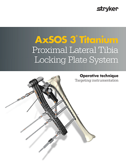 AxSOS 3 Titanium Proximal Lateral Tibia Locking Plate System.pdf
