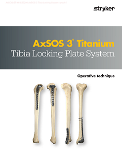 AxSOS 3 Titanium Tibia Locking Plate System.pdf