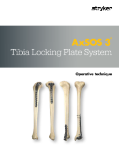 AxSOS 3 Ti Tibia operative technique