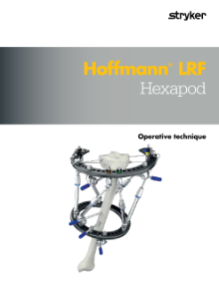 Hoffmann LRF Hexapod Operative Technique
