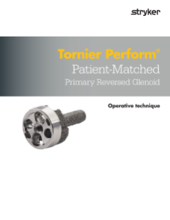 Tornier Perform Patient-Matched Op Tech