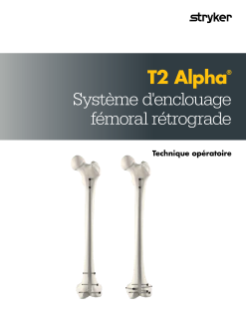 Technique opératoire T2 Alpha Rétrograde