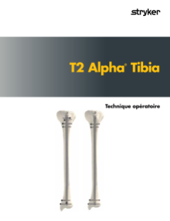 Technique opératoire T2 Alpha Tibia