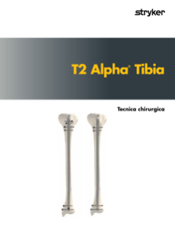 T2 Alpha® Tibia Tecnica chirurgica