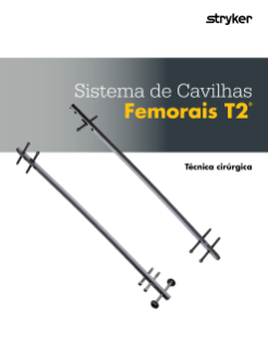 Sistema de Cavilhas Femorais T2® Técnica cirúrgica