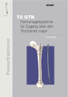 T2 GTN Femurnagelsysteme für Zugang über den Trochanter major OP-Technik