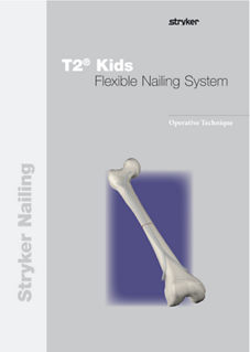 T2 Kids Flexible Nailing System operative technique