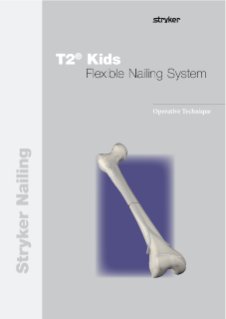 T2 Kids Flexible Nailing operative technique