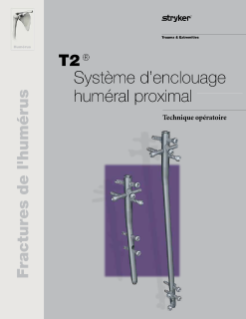 Technique Opératoire T2 Proximal Humérus