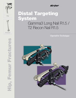 Distal Targeting System Gamma3 Long Nail R2.0/T2 Recon Nail R1.5